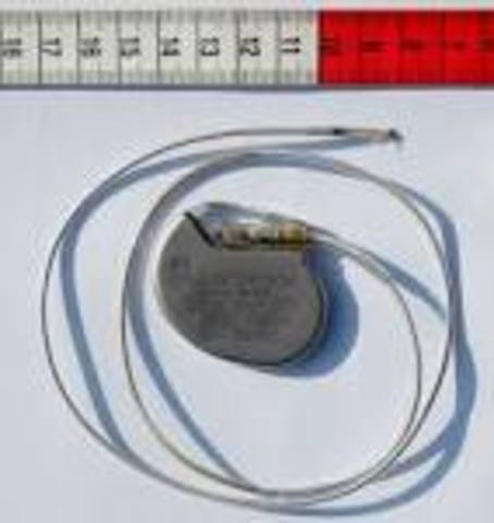 Artificial Cardiac Pacemaker