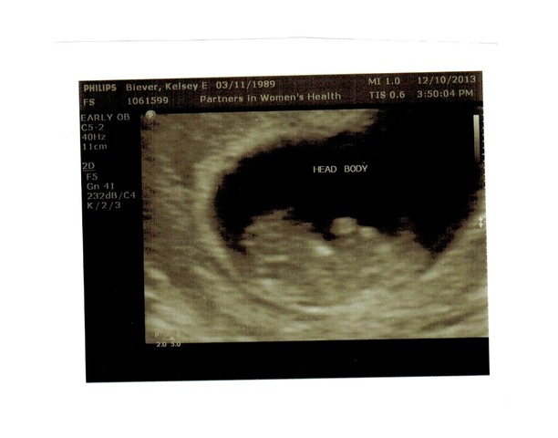 Our Third Little Miracle