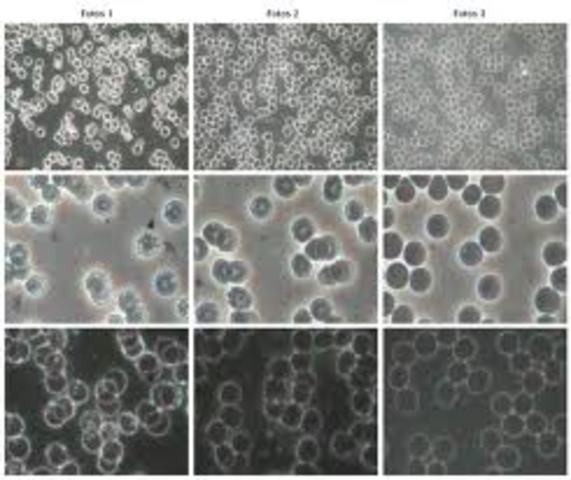 Descubrimiento de un compuesto hormonal