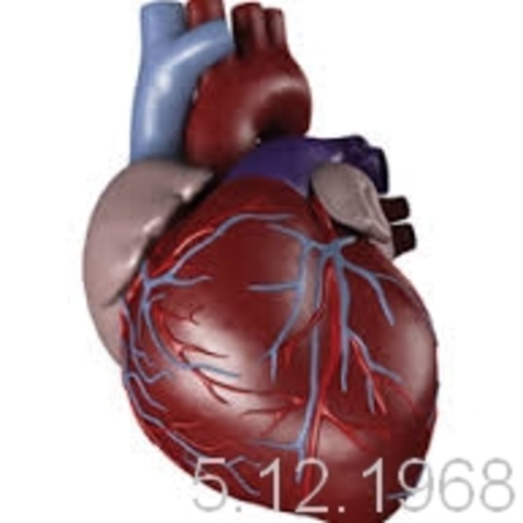 השתלת הלב הראשונה בישראל