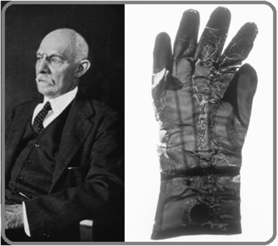 Utilización de guantes de latex