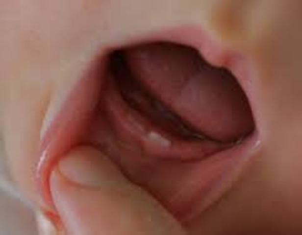 first tooth