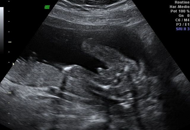 The day that everything began!