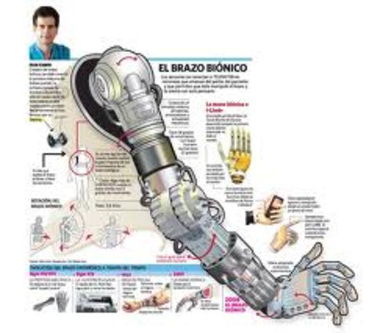 Brazo biónico