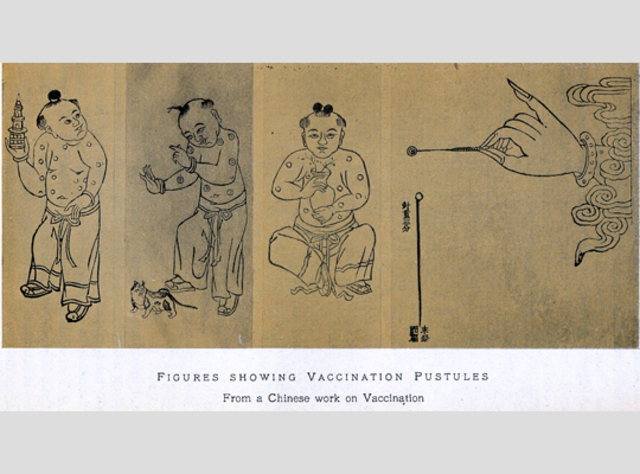 Earliest account of inoculation of smallpox in China