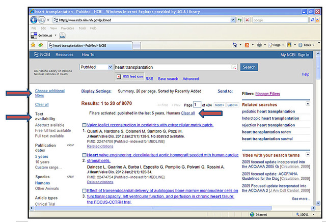 empezamos a navegar por internet  atraves de la linea telefonica