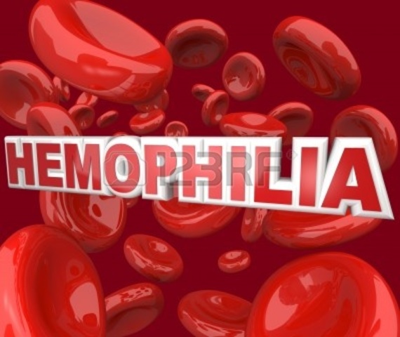 Me diagnostican Hemofilia