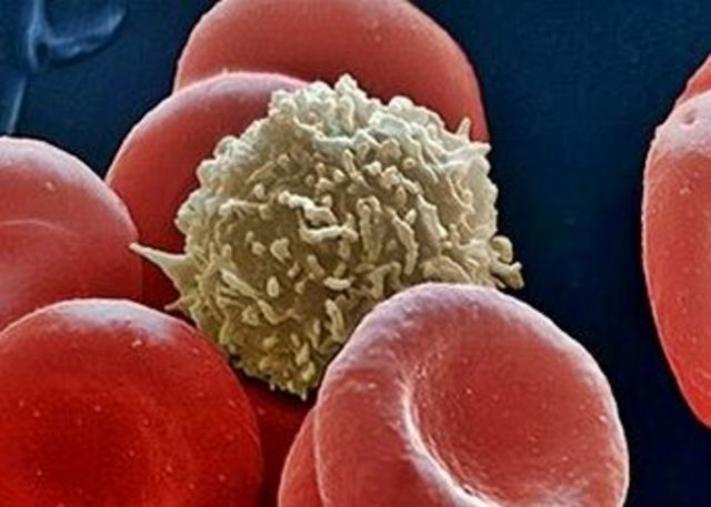 Teoria de los fagocitos