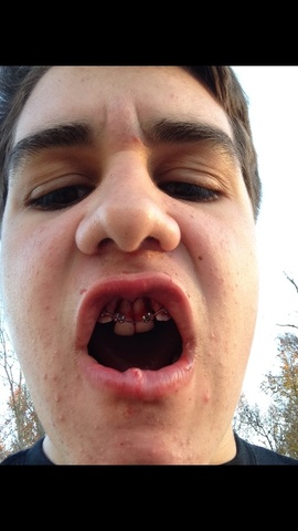 Knocked My Teeth Out Just About