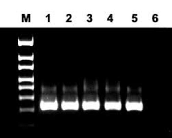 Kary Mullis inveta la PCR, que permite amplificar genes.