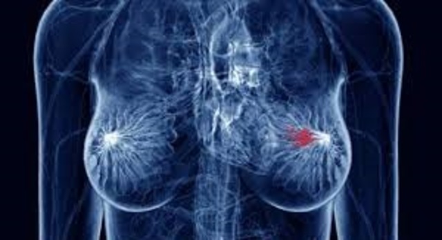 Primer gen de cáncer de mama.