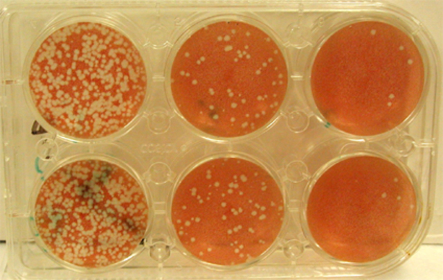 Primeros Cultivos de virus