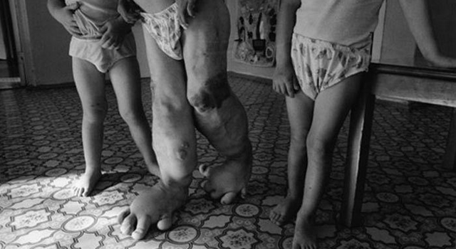 The Chernobyl Nuclear Explosion