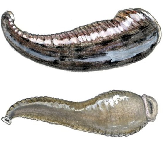 If channels became clogged, blood letting or leeches were used to open them.