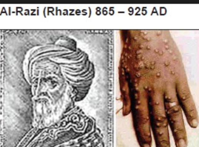 Rhazes discovered difference between smallpox and measles
