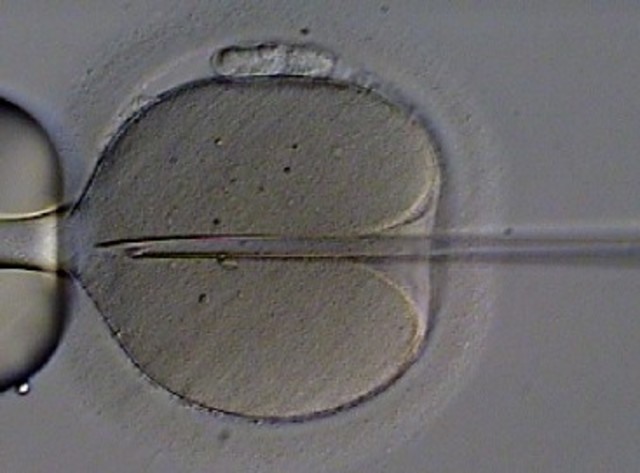 Fécondation In Vitro