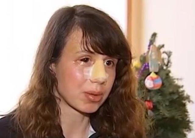 Journalist Brutally Attacked