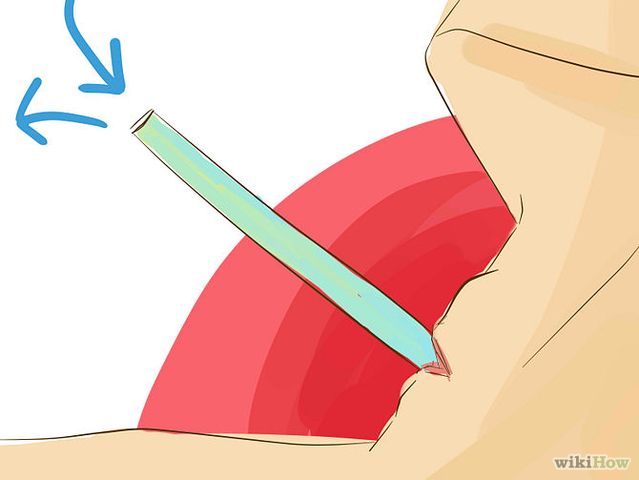 Galen;tracheotomy openig surgery created through the neck
