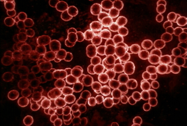 Rhazes discovered difference between smallpox and measles