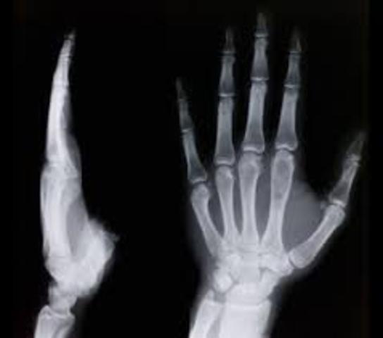 X-rays