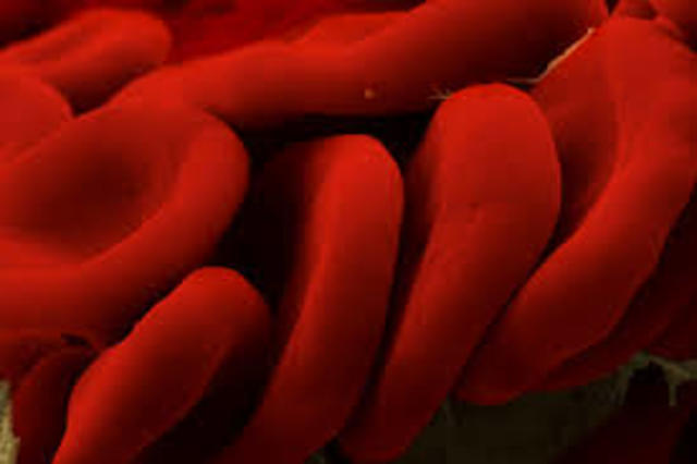 Pare intruoduced loss of blood