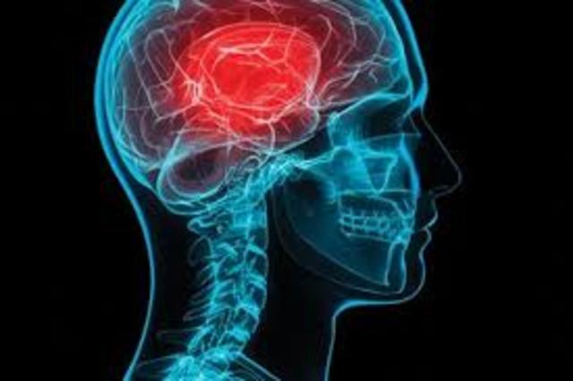 Zurich Conference Consensus Statement