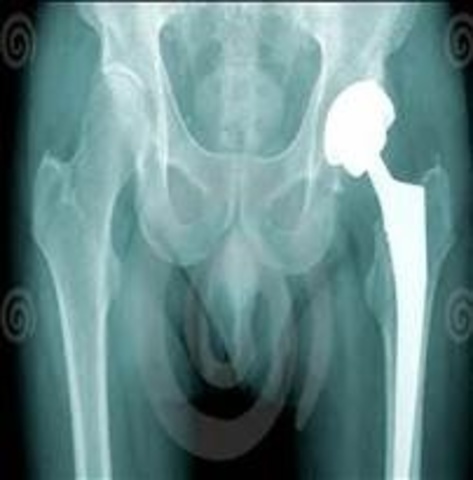 End specialized training