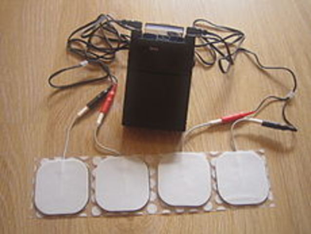 The Invention of Transcutaneous Electrical Nerve Stimulation (TENS)