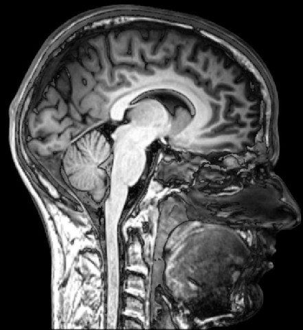 The First MRI Image