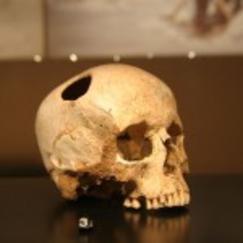 Prehistoric "doctors" 25,000 BC+