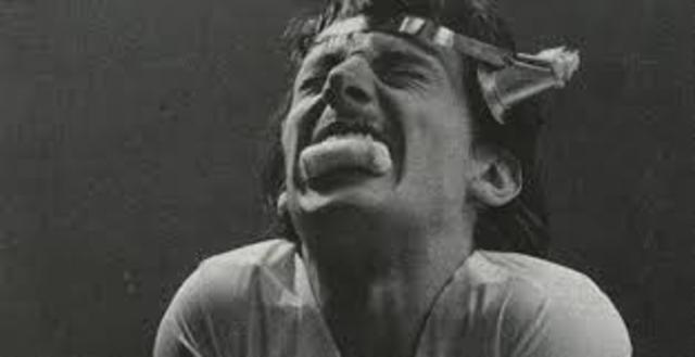 Electroshock Therapy