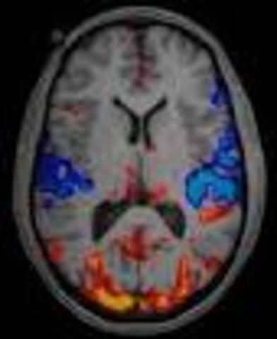 fMRI