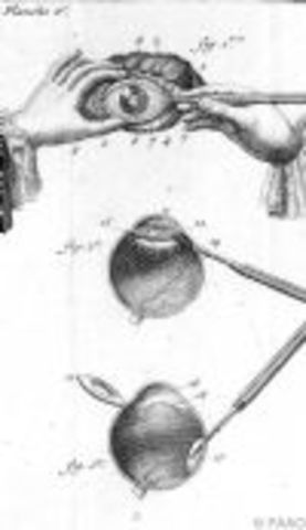 Verification that cataract occurs in the lens