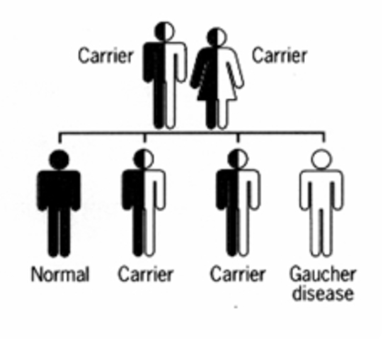 Gaucher Disease recognized as 'Inherited'