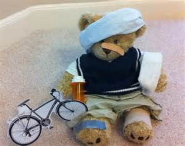 Una vez me rompí la nariz.