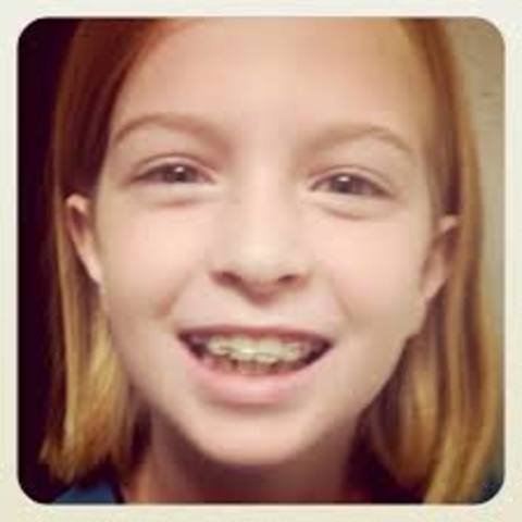 Poner frenillos en 2010.