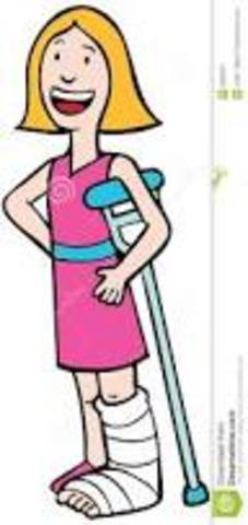 Yo estaba acostado en la cama cuando de repente yo deslicé y me fracture clavícula.