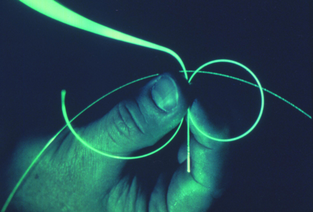 Se finaliza el cable TAT