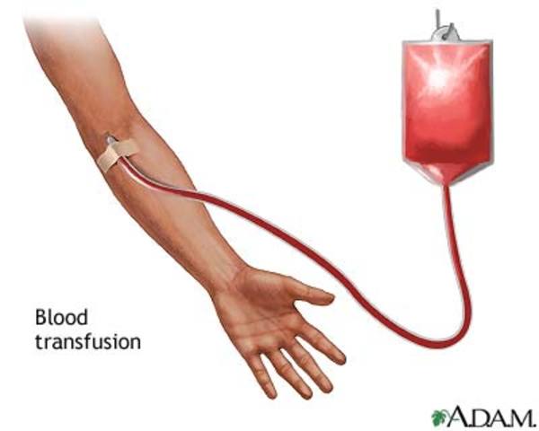 If Karl Landsteiner hadn’t discovered the different types of blood; blood’s transfusions wouldn’t have been possible.