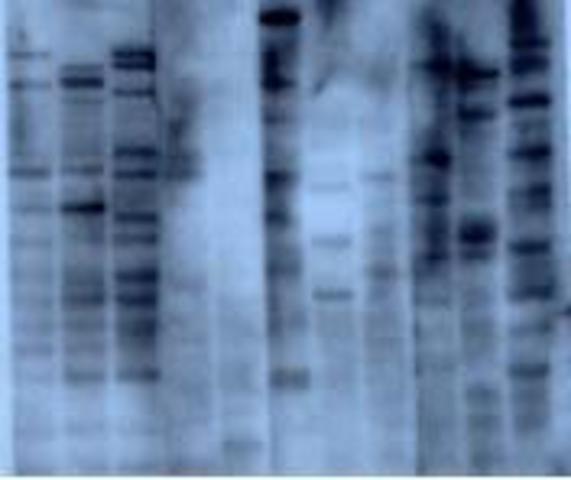 Genetic Fingerprinting