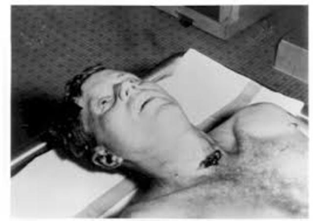 Kennedy Assassination