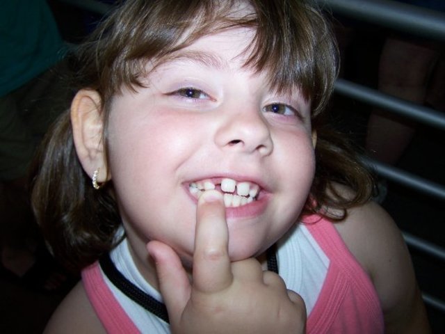 Lost 1st Tooth