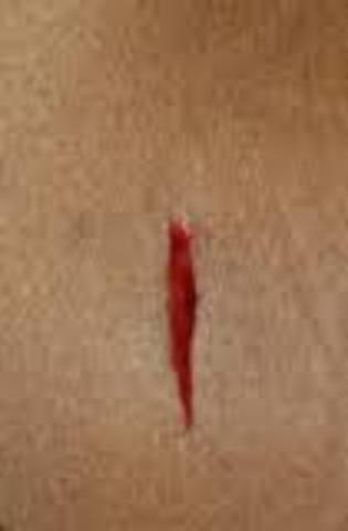 the day I cut my leg