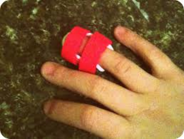 Fractured Finger.