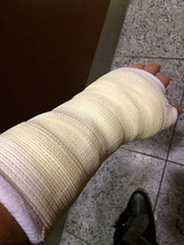 Breaking my Wrist