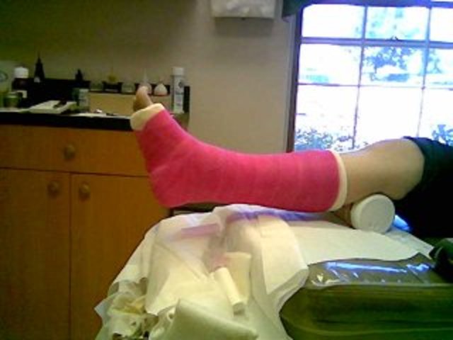 Broken Leg