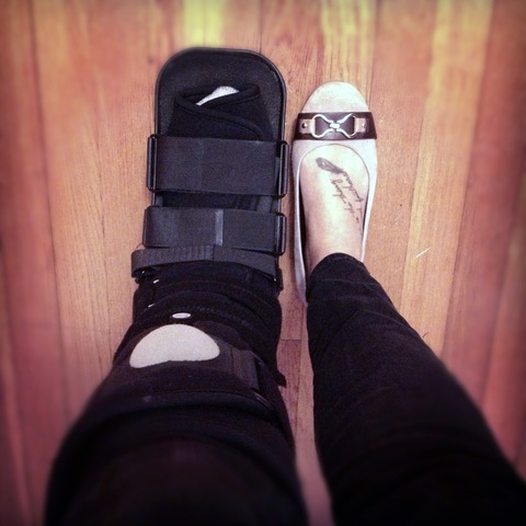 When i brokemy foot.