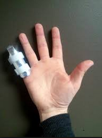 The day i broke my pinkie