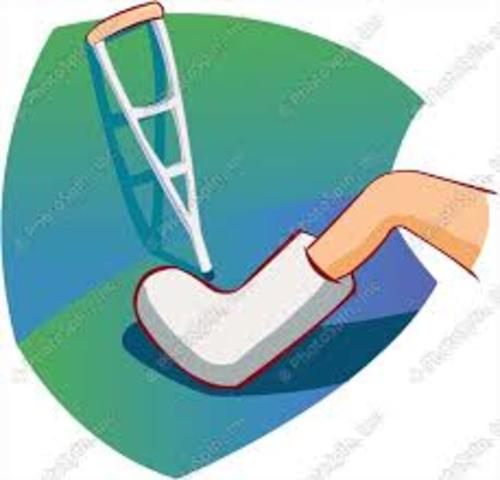 When I Broke My Foot