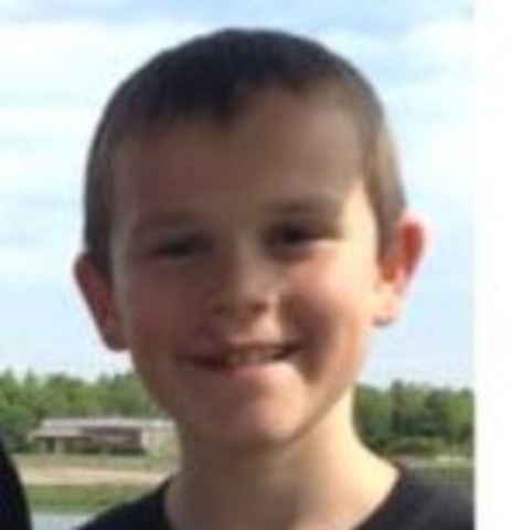 Getting Hit By A Baseball